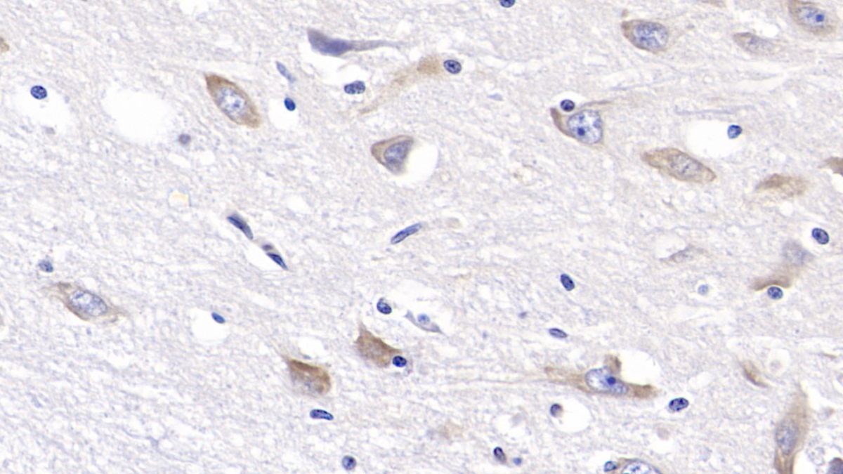 Monoclonal Antibody to Reelin (RELN)