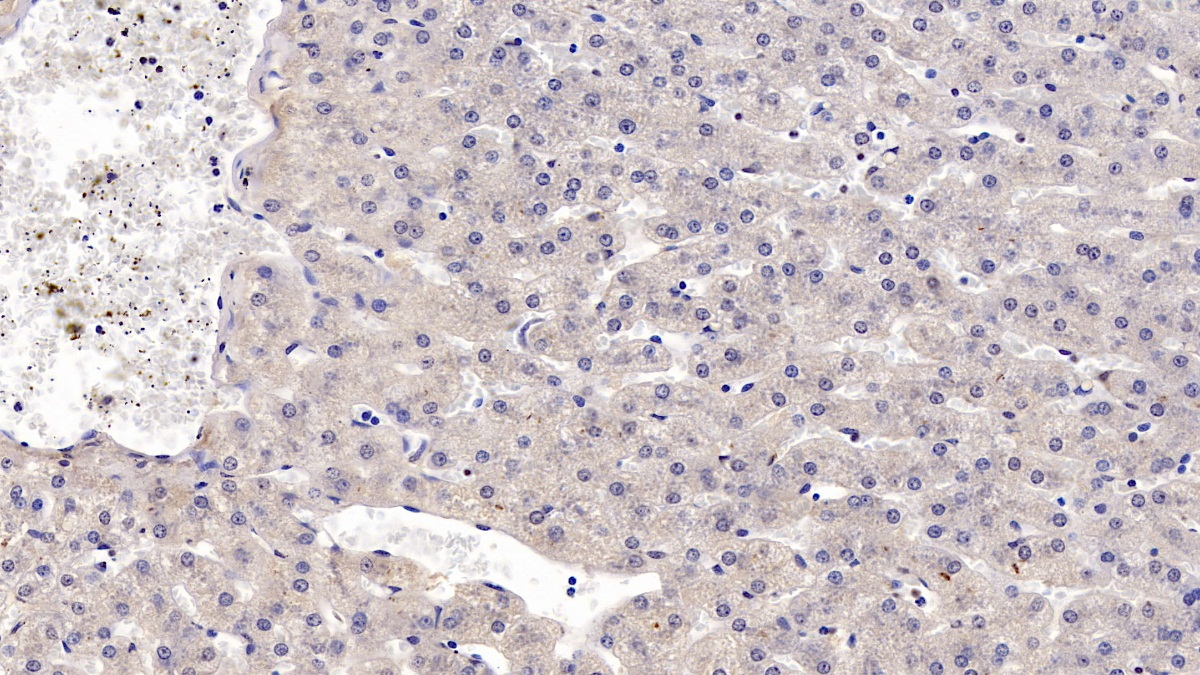 Monoclonal Antibody to Thymidine Kinase 1, Soluble (TK1)