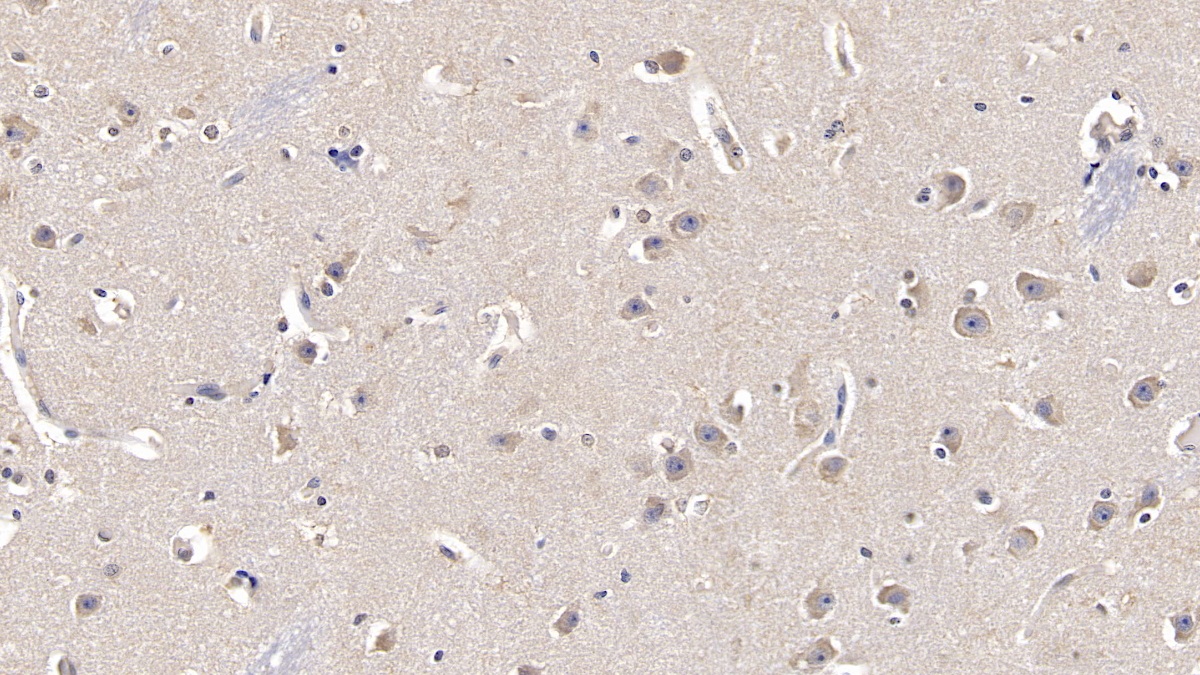 Monoclonal Antibody to Fibroblast Growth Factor 13 (FGF13)