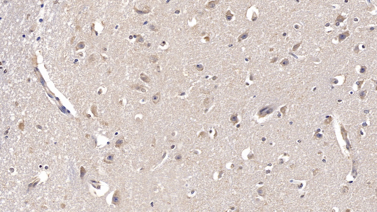 Monoclonal Antibody to Fibroblast Growth Factor 13 (FGF13)
