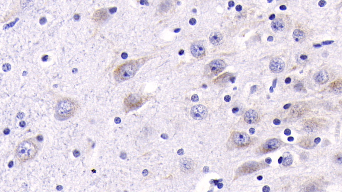 Monoclonal Antibody to Cathepsin B (CTSB)