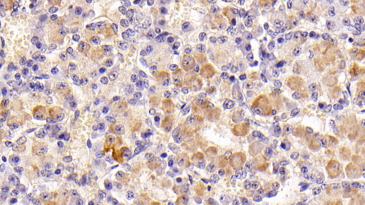 Monoclonal Antibody to Follicle Stimulating Hormone Beta (FSHb)