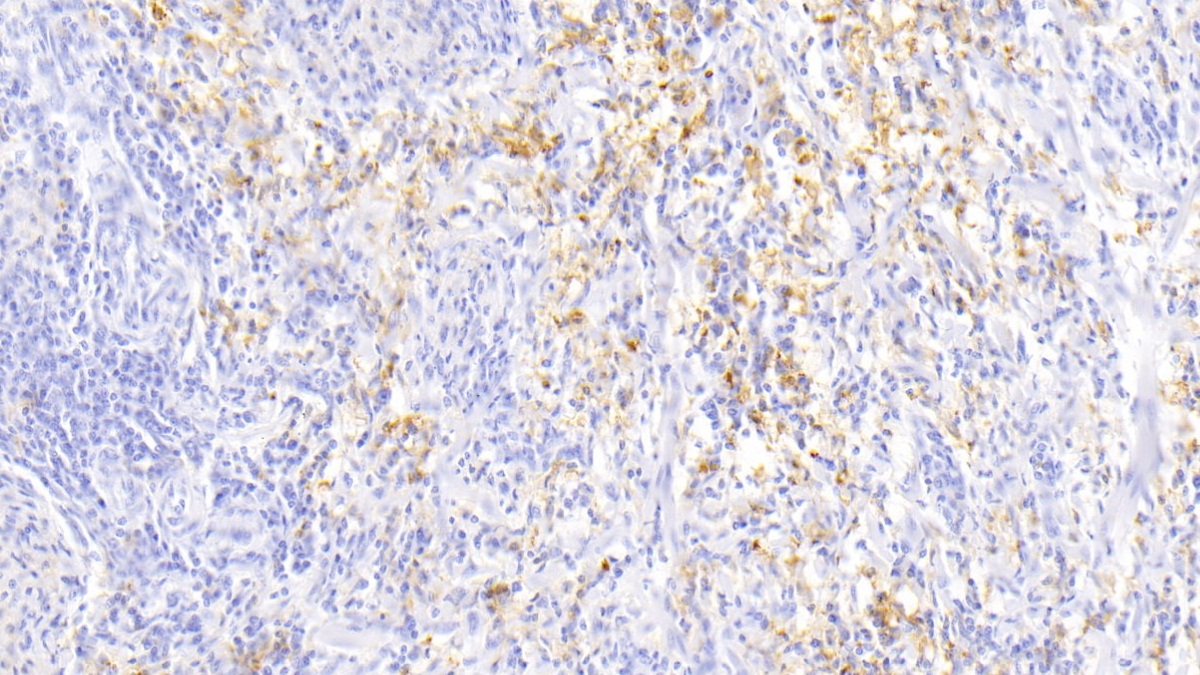 Monoclonal Antibody to Ferritin, Light Polypeptide (FTL)
