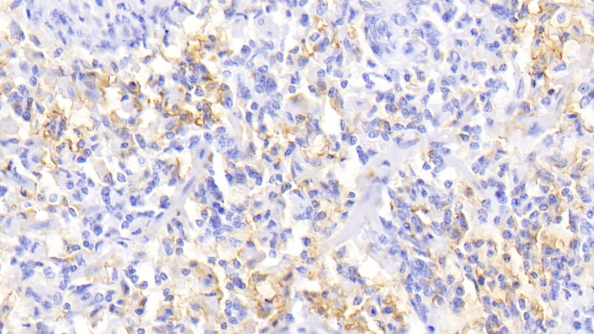 Monoclonal Antibody to Ferritin, Light Polypeptide (FTL)