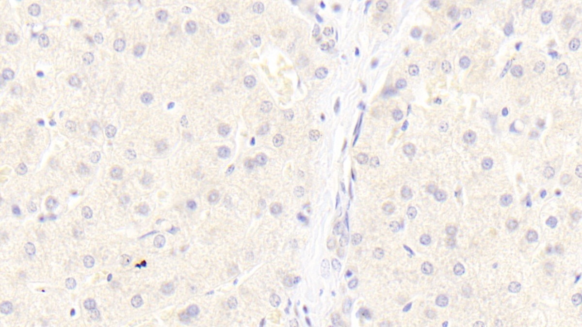 Monoclonal Antibody to Low Density Lipoprotein Receptor Related Protein 6 (LRP6)