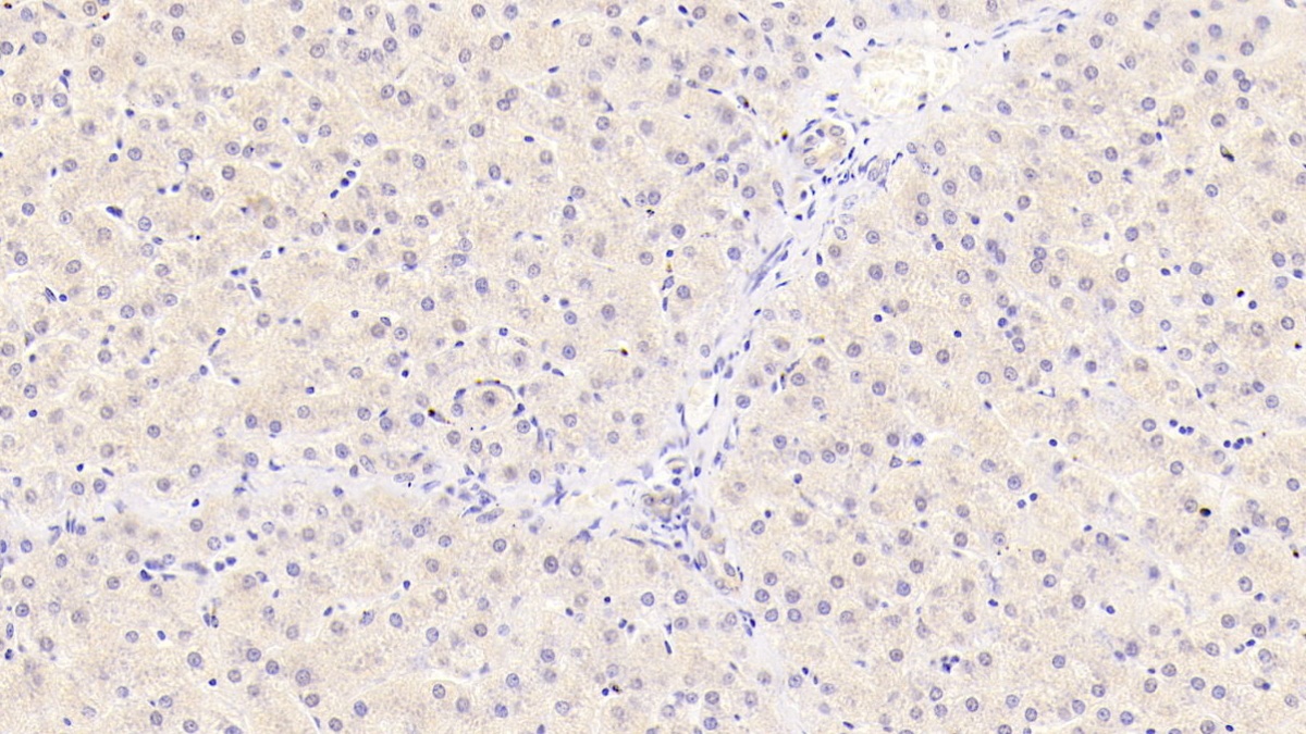 Monoclonal Antibody to Syntenin 2 (ST2)