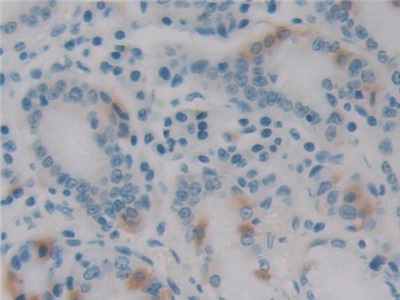 Monoclonal Antibody to Epstein Barr Virus Induced Protein 3 (EBI3)