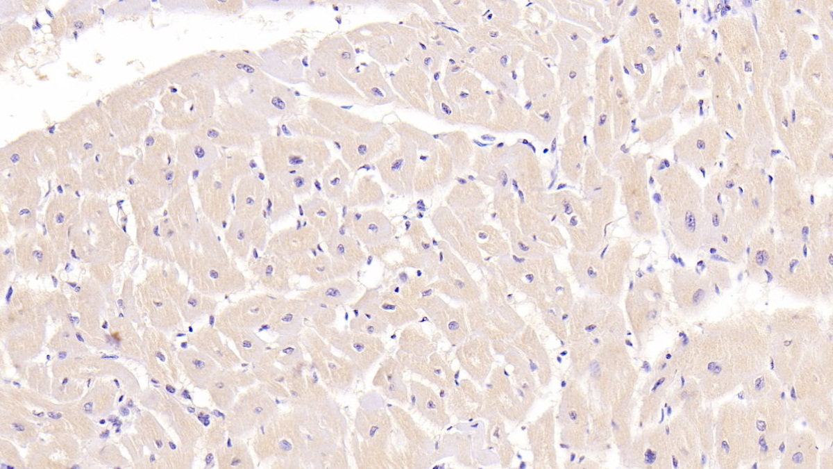 Monoclonal Antibody to Troponin T Type 2, Cardiac (TNNT2)