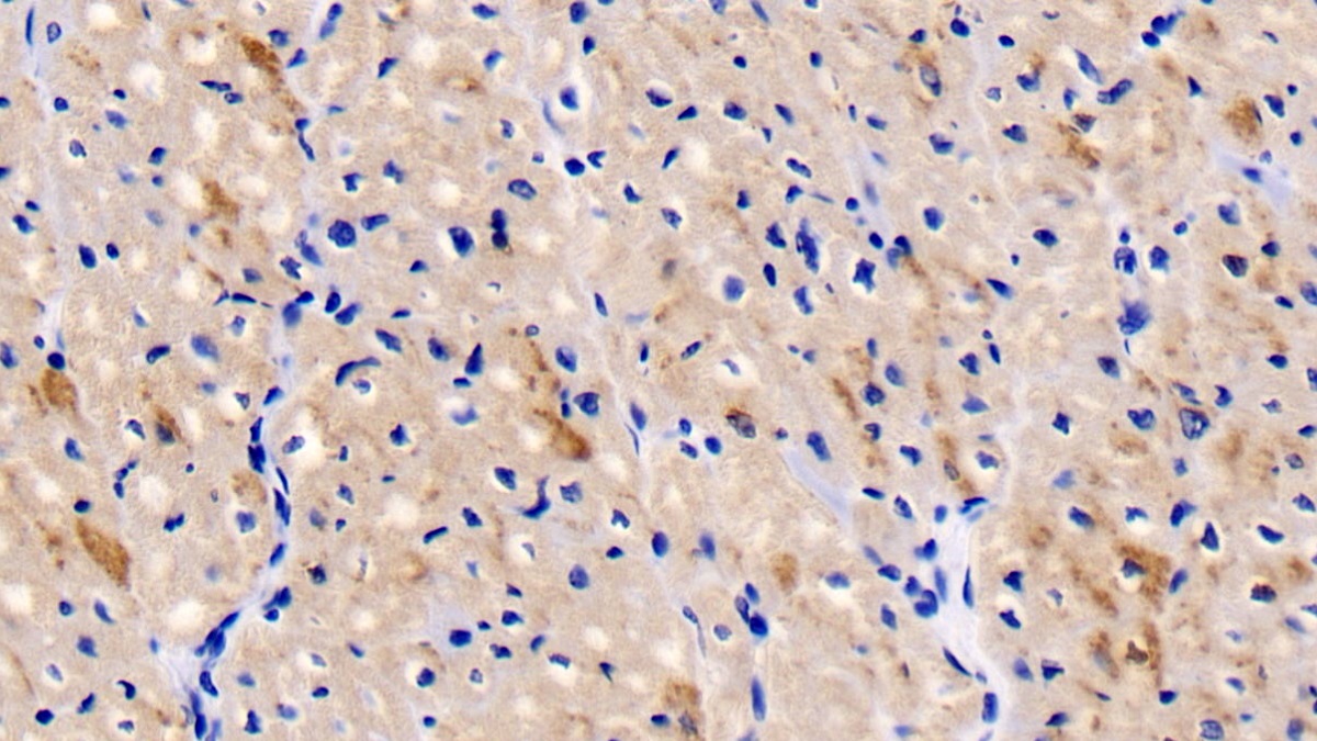 Monoclonal Antibody to Troponin T Type 2, Cardiac (TNNT2)