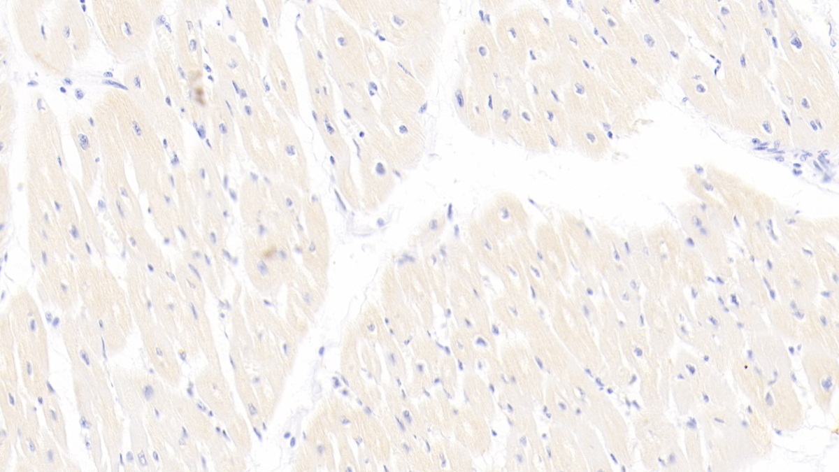 Monoclonal Antibody to Troponin T Type 2, Cardiac (TNNT2)