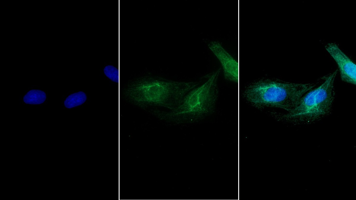 Monoclonal Antibody to Myosin Heavy Chain 8, Skeletal Muscle, Perinatal (MYH8)