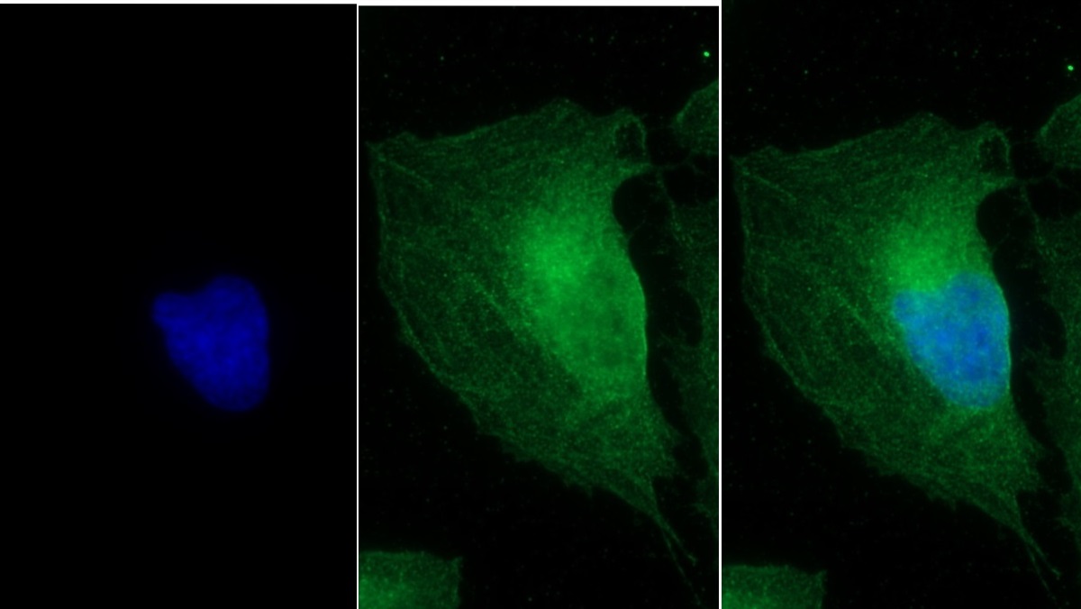 Monoclonal Antibody to Myosin Heavy Chain 8, Skeletal Muscle, Perinatal (MYH8)