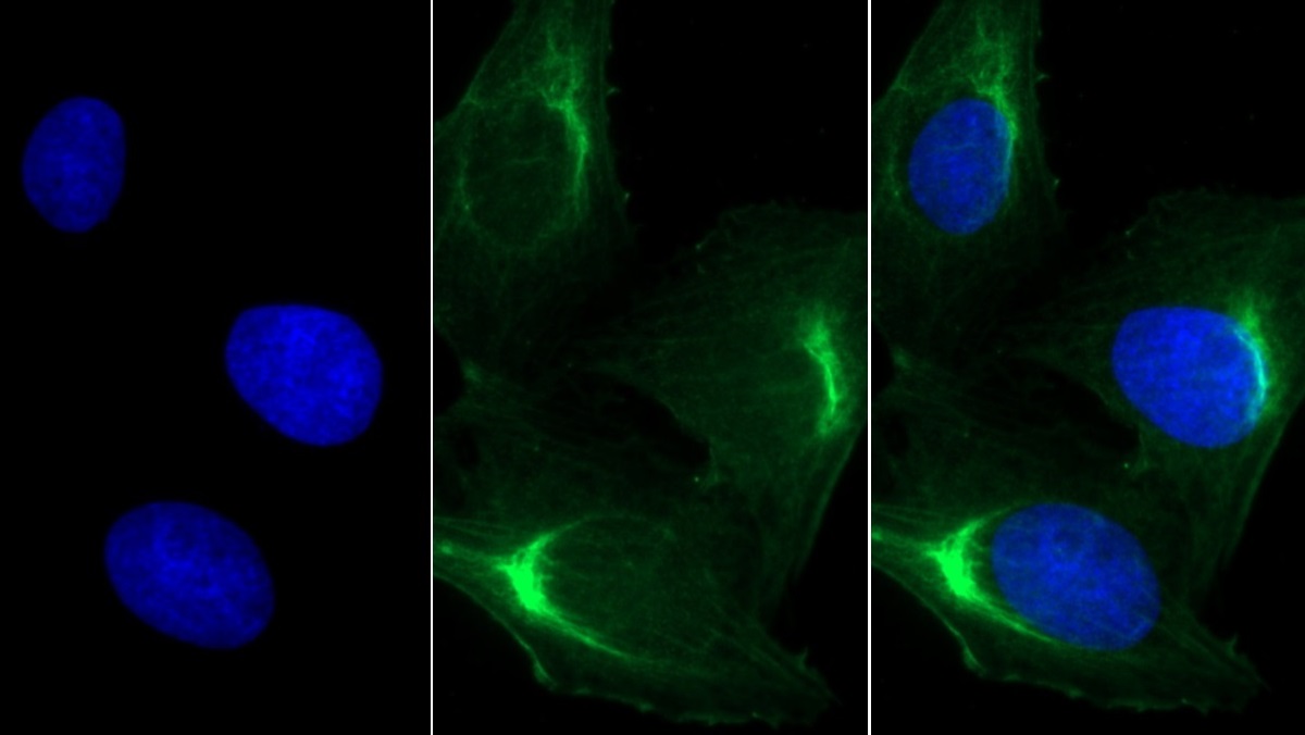 Monoclonal Antibody to Myosin Heavy Chain 8, Skeletal Muscle, Perinatal (MYH8)