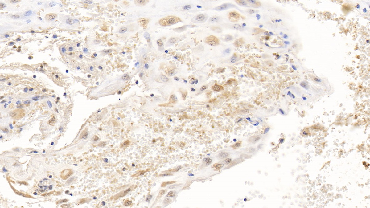 Monoclonal Antibody to Apolipoprotein L2 (APOL2)