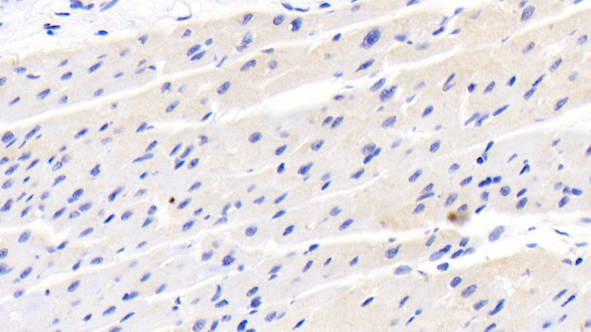 Monoclonal Antibody to Diazepam Binding Inhibitor (DBI)