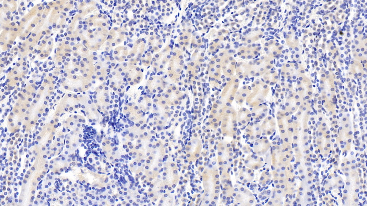Monoclonal Antibody to Deoxythymidylate Kinase (DTYMK)
