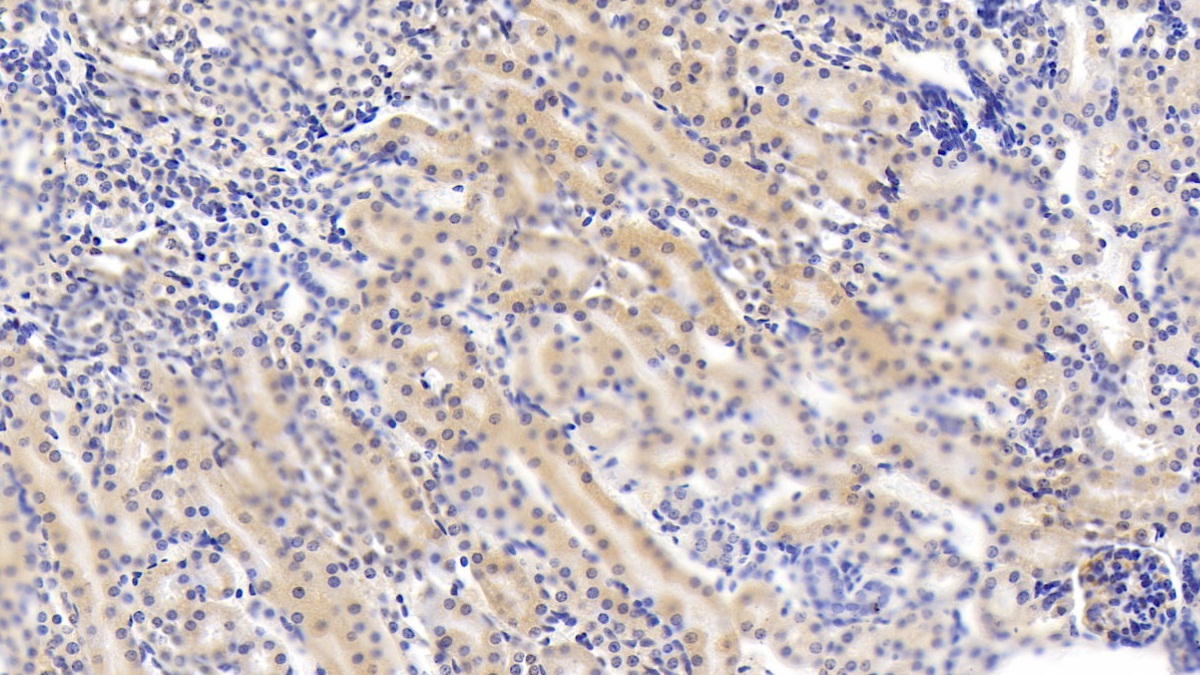 Monoclonal Antibody to Deoxythymidylate Kinase (DTYMK)