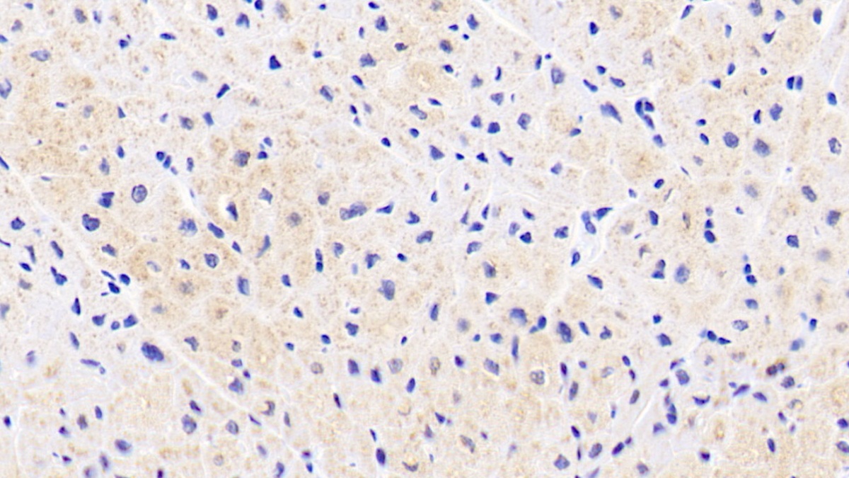 Monoclonal Antibody to Aspartate Aminotransferase 2 (AST2)