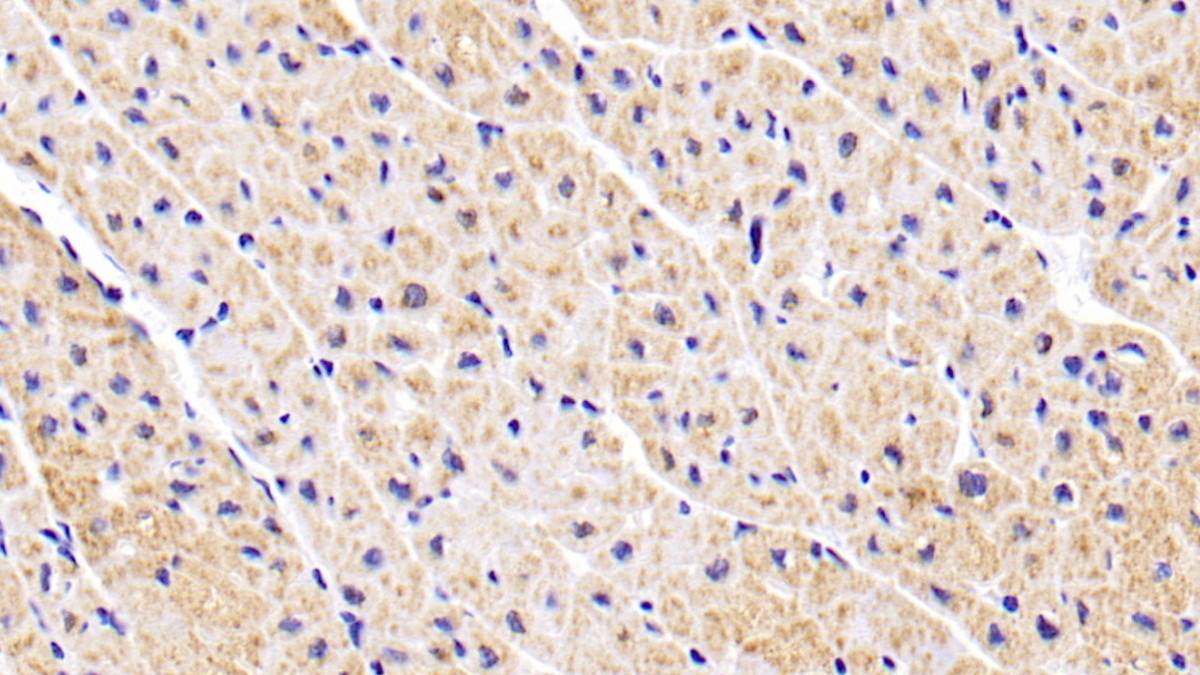 Monoclonal Antibody to Aspartate Aminotransferase 2 (AST2)