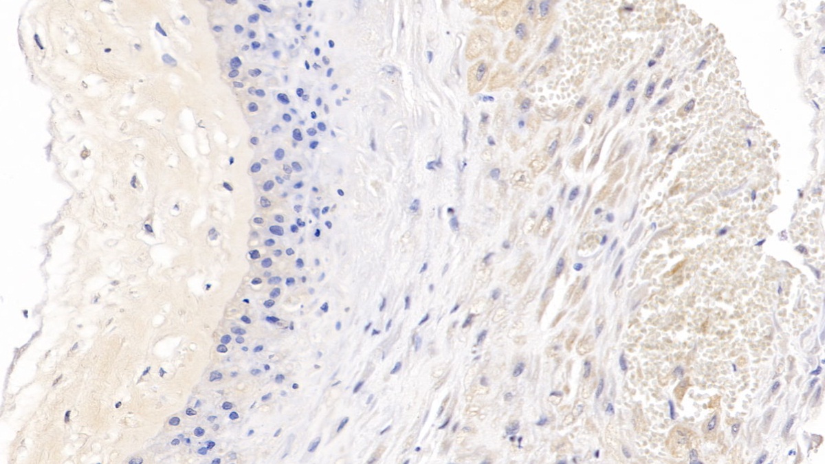 Monoclonal Antibody to C-Ros Oncogene 1, Receptor Tyrosine Kinase (ROS1)