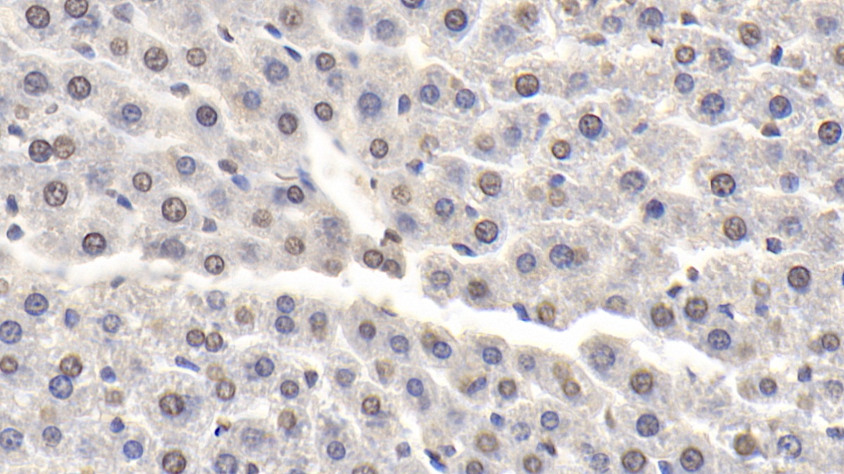 Monoclonal Antibody to Receptor Interacting Serine Threonine Kinase 3 (RIPK3)