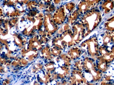 Monoclonal Antibody to Annexin A1 (ANXA1)