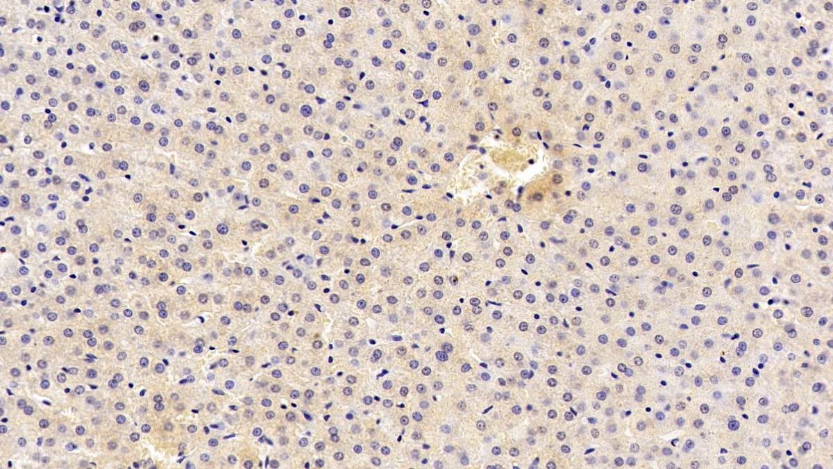 Monoclonal Antibody to Anthrax Toxin Receptor 2 (ANTXR2)