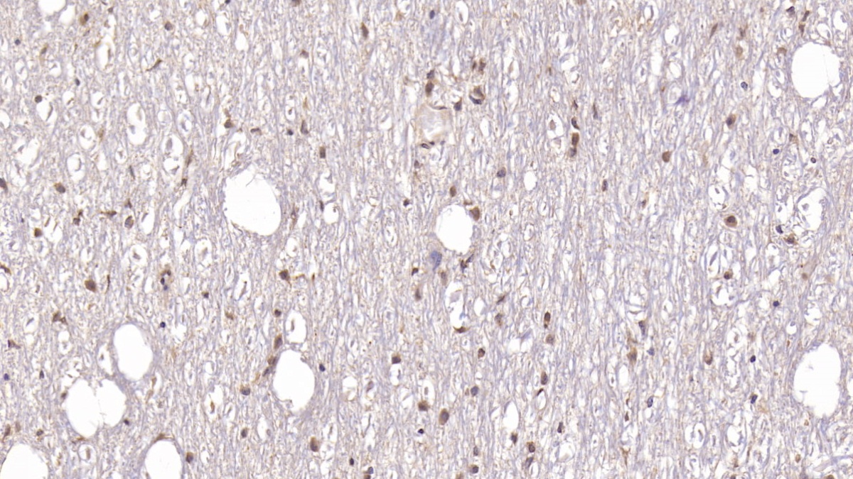Monoclonal Antibody to Doublecortin Like Kinase 1 (DCLK1)