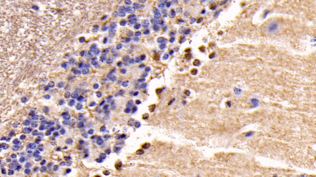 Monoclonal Antibody to Phosphatase And Tensin Homolog (PTEN)