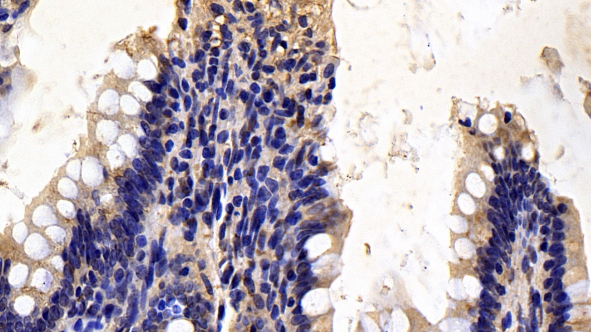 Monoclonal Antibody to Secreted Frizzled Related Protein 1 (SFRP1)