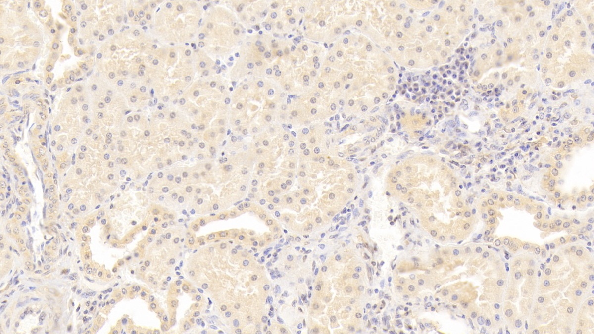 Monoclonal Antibody to Immunoglobulin Superfamily Containing Leucine Rich Repeat Protein (ISLR)
