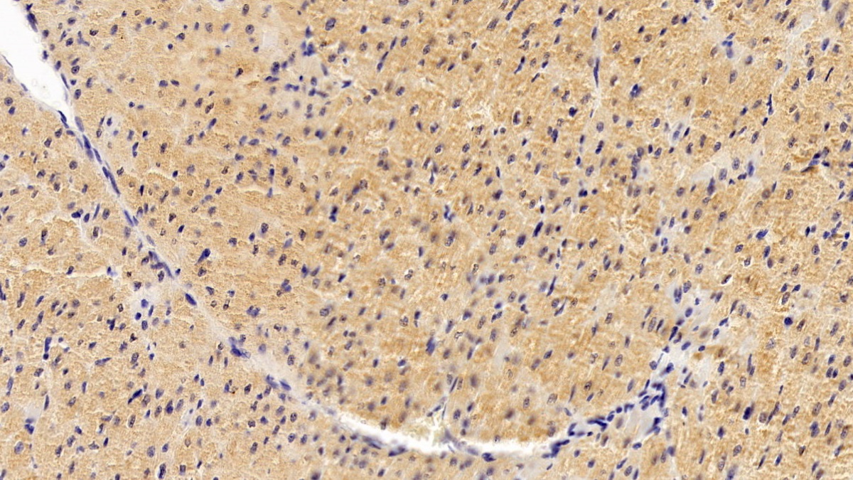 Monoclonal Antibody to Wolfram Syndrome Protein 1 (WFS1)