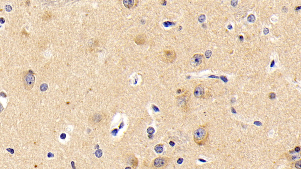 Monoclonal Antibody to Microtubule Associated Protein 1 Light Chain 3 Alpha (MAP1LC3a)