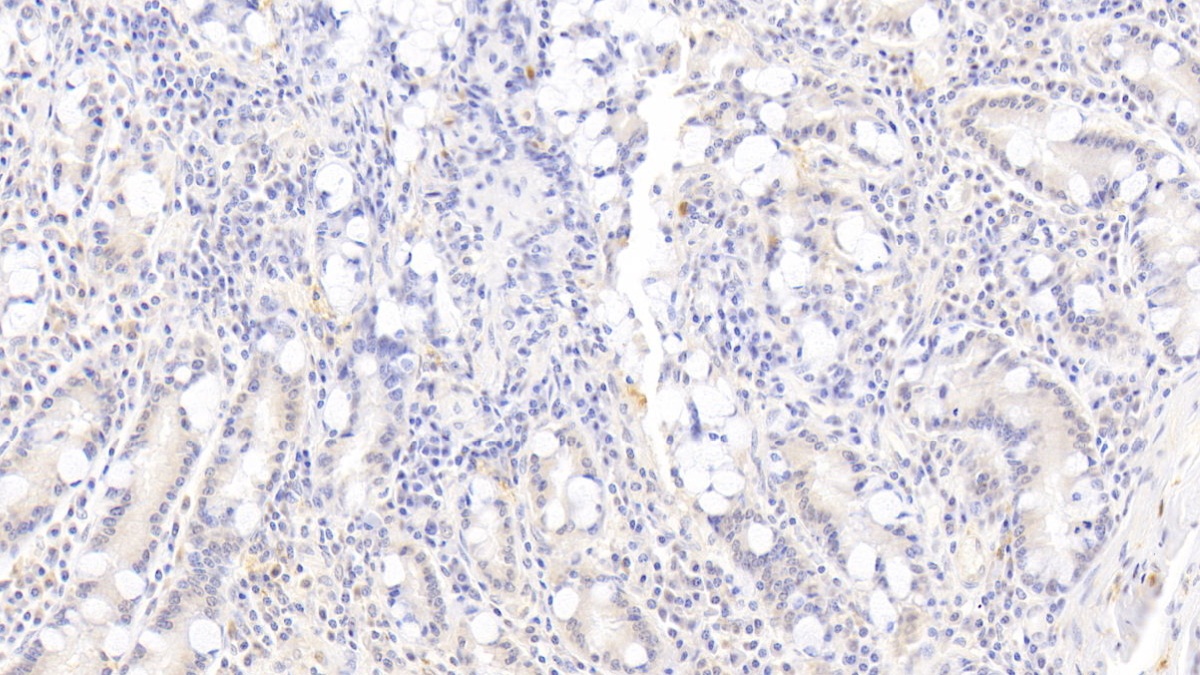 Monoclonal Antibody to Ras Related C3 Botulinum Toxin Substrate 1 (Rac1)