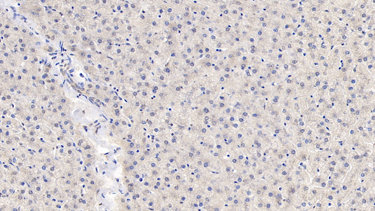Monoclonal Antibody to Angiopoietin Like Protein 8 (ANGPTL8)