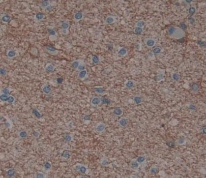 Polyclonal Antibody to Brain Derived Neurotrophic Factor (BDNF)