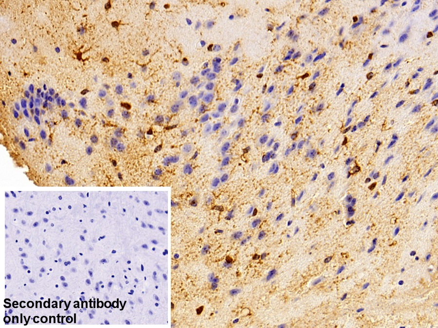 Polyclonal Antibody to S100 Calcium Binding Protein (S100)