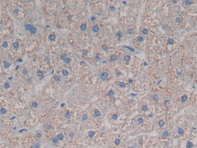 Polyclonal Antibody to Chemokine C-C-Motif Ligand 3 Like Protein 1 (CCL3L1)