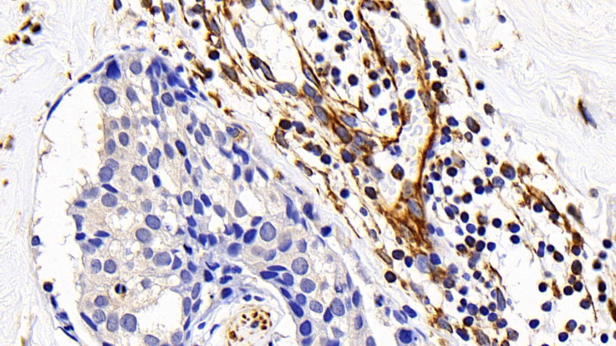 Polyclonal Antibody to Factor Related Apoptosis (FAS)