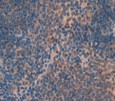 Polyclonal Antibody to Factor Related Apoptosis Ligand (FASL)