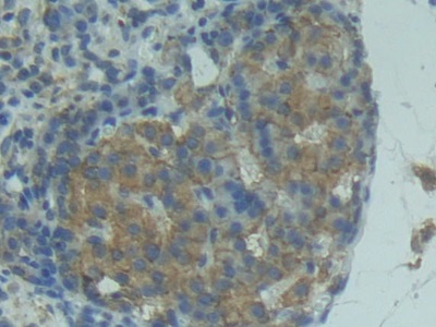 Polyclonal Antibody to Factor Related Apoptosis Ligand (FASL)