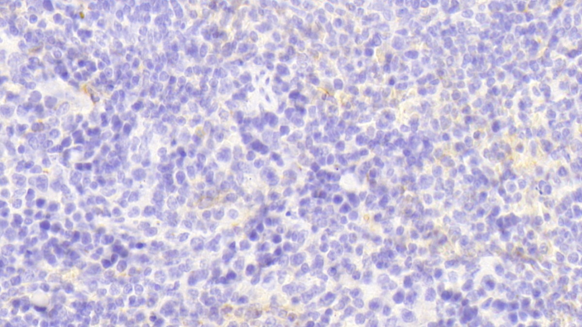 Polyclonal Antibody to Colony Stimulating Factor 2, Granulocyte Macrophage (GM-CSF)