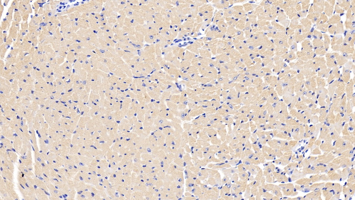 Polyclonal Antibody to Insulin Like Growth Factor Binding Protein 2 (IGFBP2)
