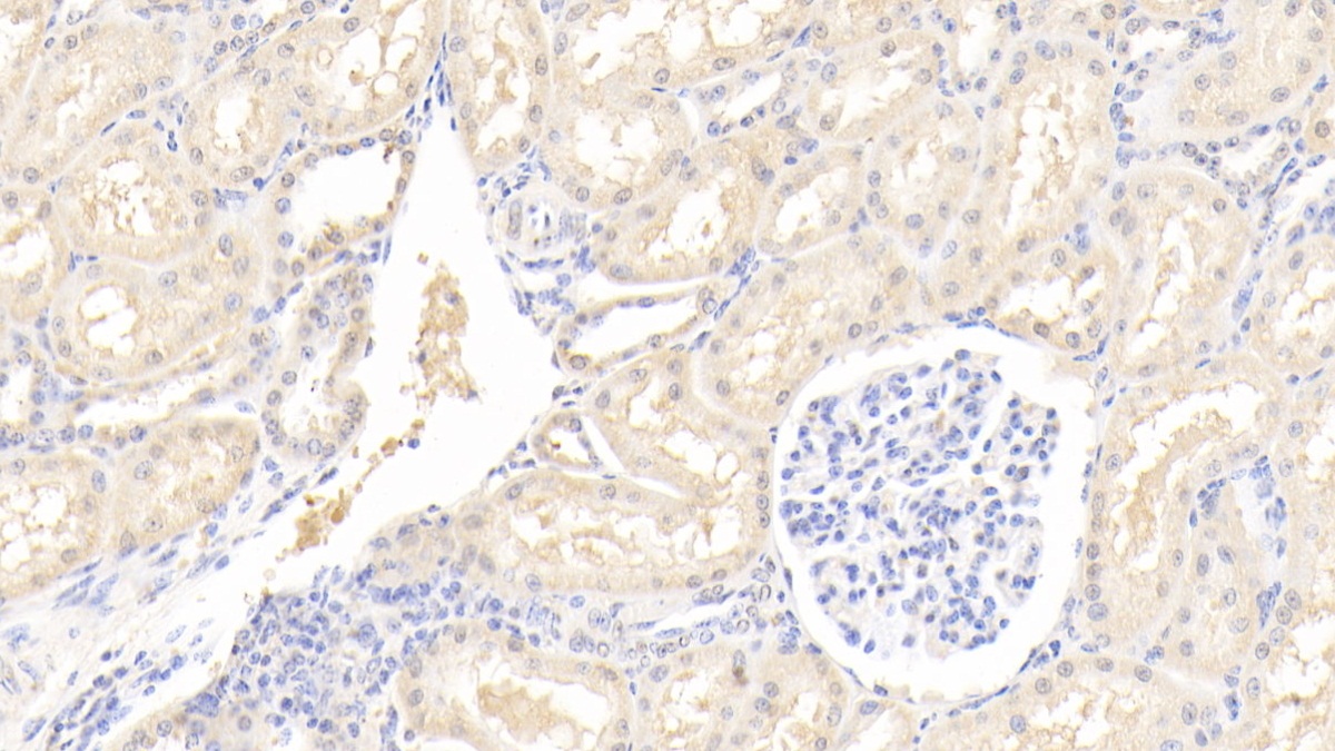 Polyclonal Antibody to Interleukin 12B (IL12B)