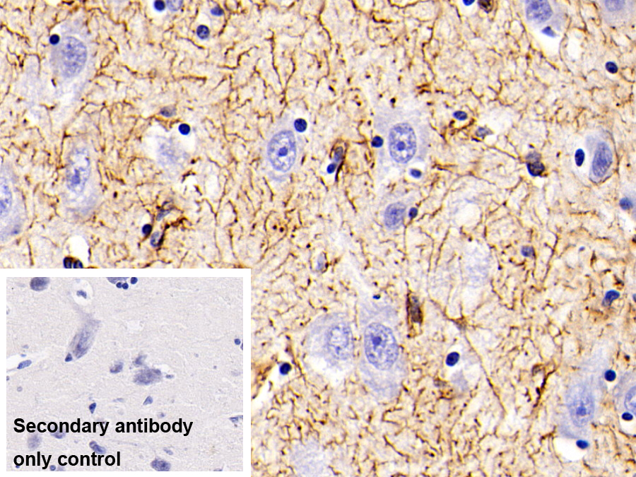 Polyclonal Antibody to Glial Fibrillary Acidic Protein (GFAP)