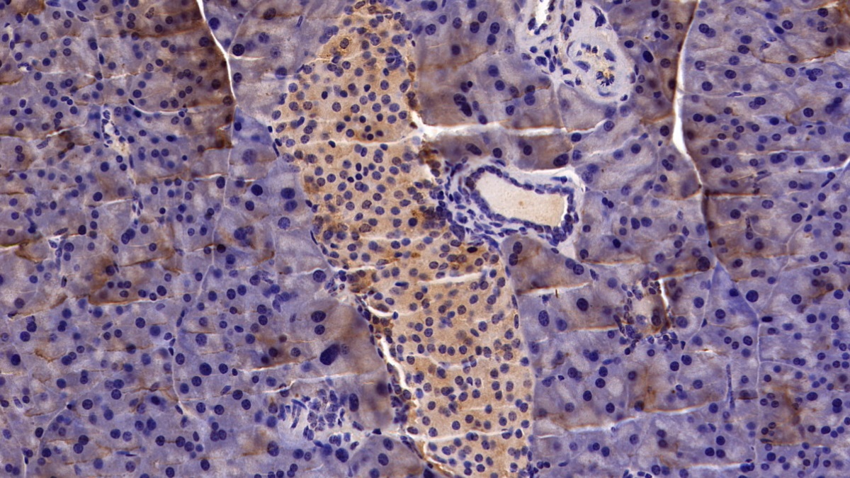 Polyclonal Antibody to Meningioma Expressed Antigen 5 (MGEA5)