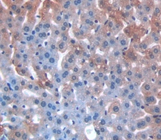 Polyclonal Antibody to Meningioma Expressed Antigen 5 (MGEA5)