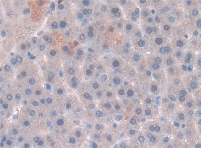 Polyclonal Antibody to Leptin (LEP)