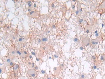 Polyclonal Antibody to Leukemia Inhibitory Factor (LIF)