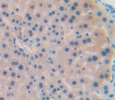 Polyclonal Antibody to Macrophage Derived Chemokine (MDC)
